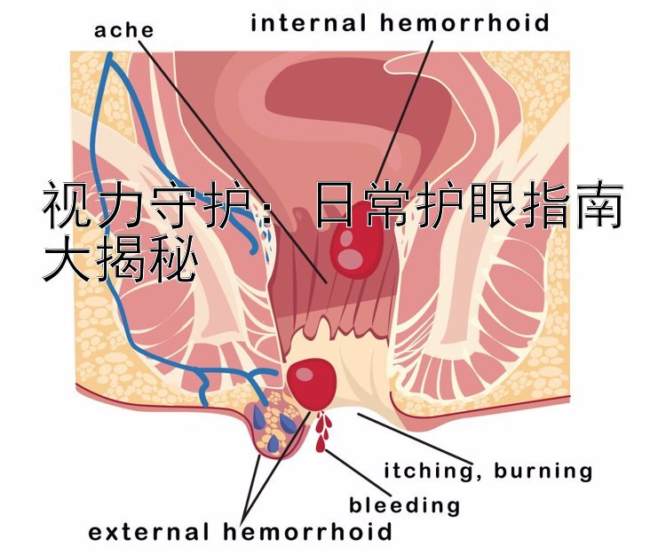 视力守护：日常护眼指南大揭秘