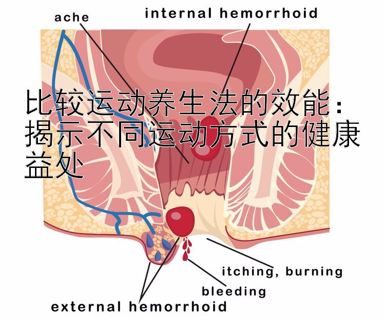 比较运动养生法的效能：揭示不同运动方式的健康益处