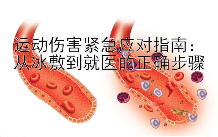 运动伤害紧急应对指南：从冰敷到就医的正确步骤