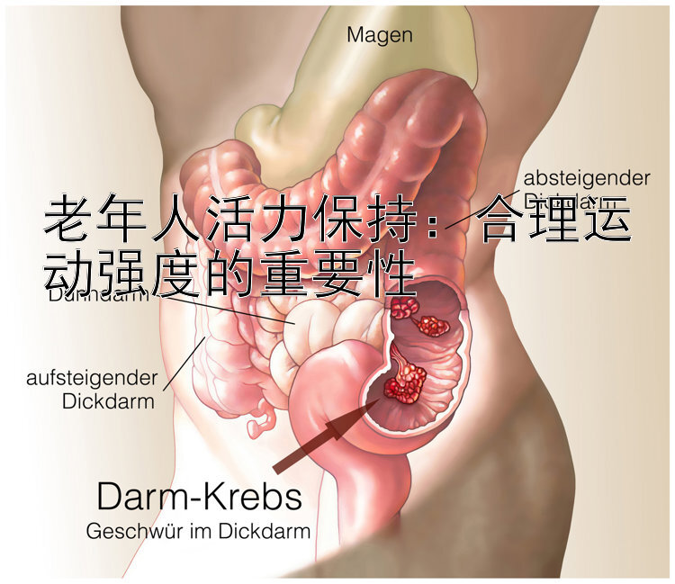 老年人活力保持：合理运动强度的重要性