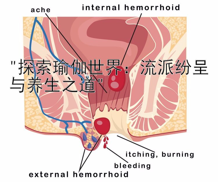 探索瑜伽世界：流派纷呈与养生之道