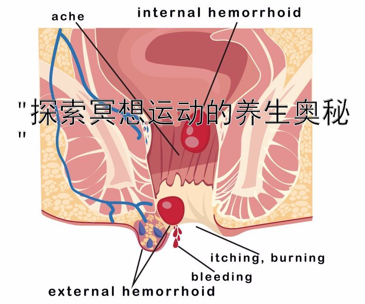 探索冥想运动的养生奥秘