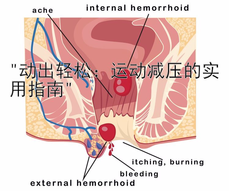 动出轻松：运动减压的实用指南