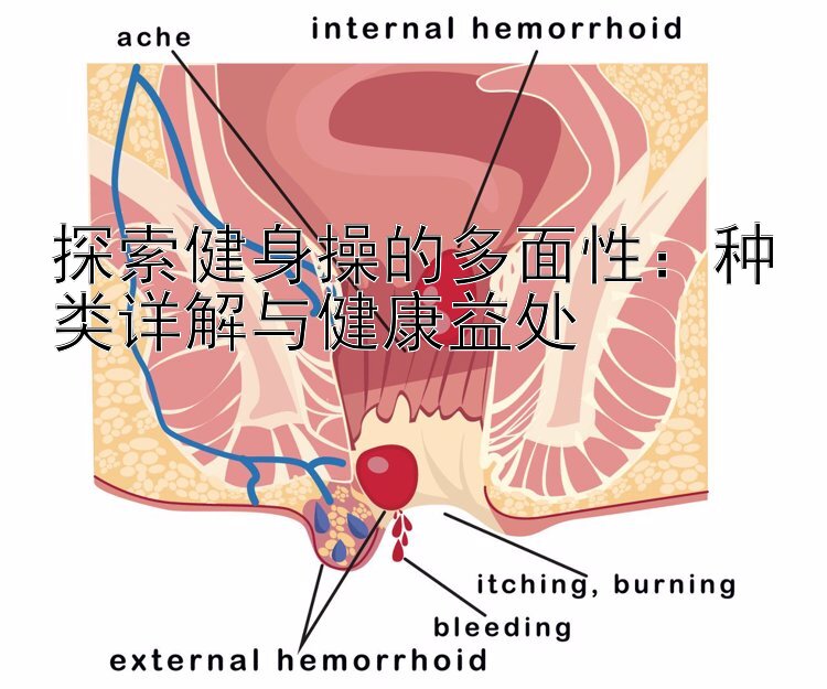 探索健身操的多面性：种类详解与健康益处