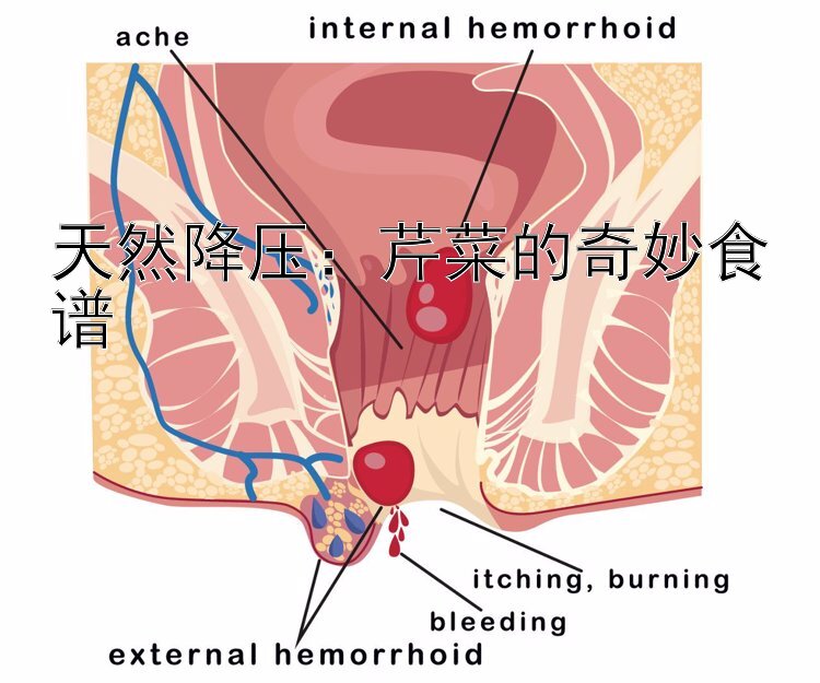 天然降压：芹菜的奇妙食谱