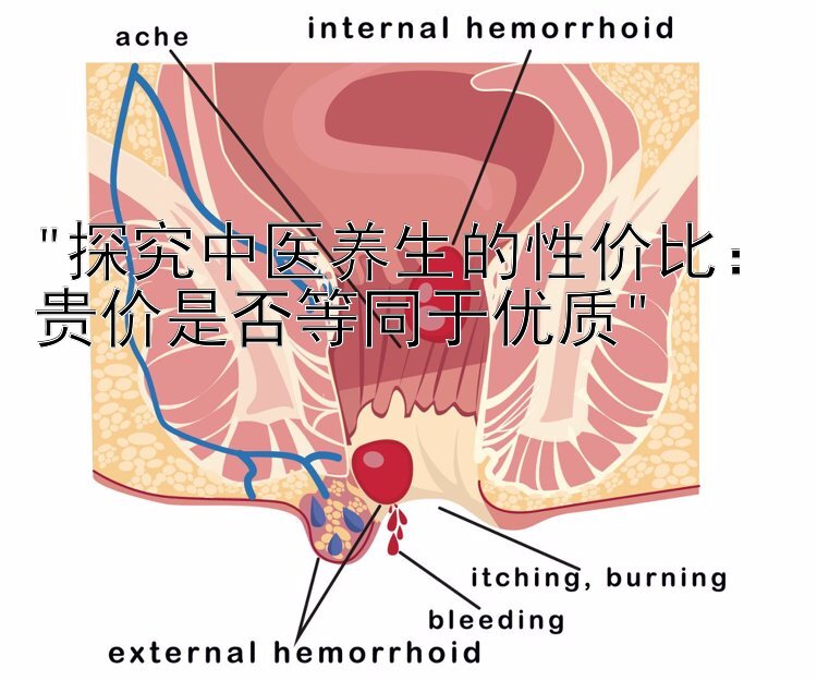 探究中医养生的性价比：贵价是否等同于优质