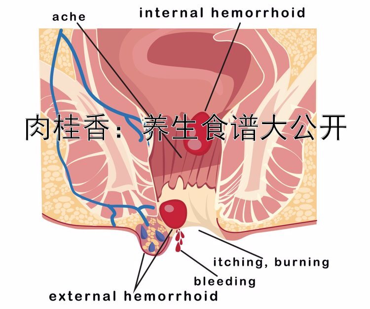 肉桂香：养生食谱大公开