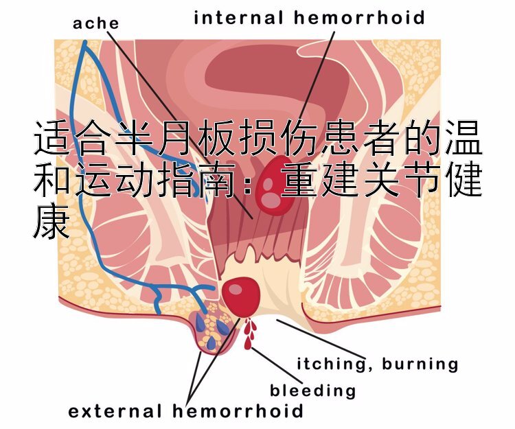 适合半月板损伤患者的温和运动指南：重建关节健康