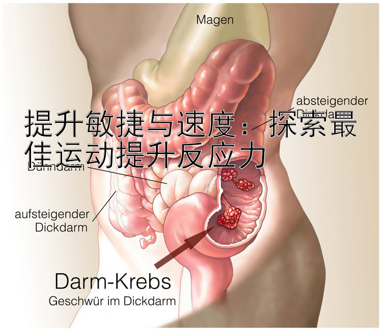 提升敏捷与速度：探索最佳运动提升反应力