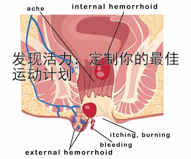 发现活力：定制你的最佳运动计划