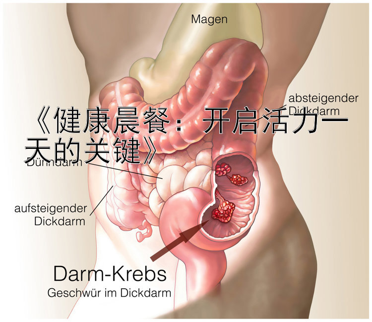 《健康晨餐：开启活力一天的关键》