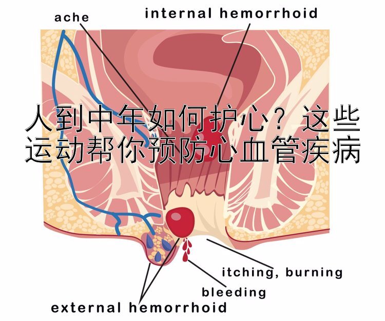 人到中年如何护心？这些运动帮你预防心血管疾病