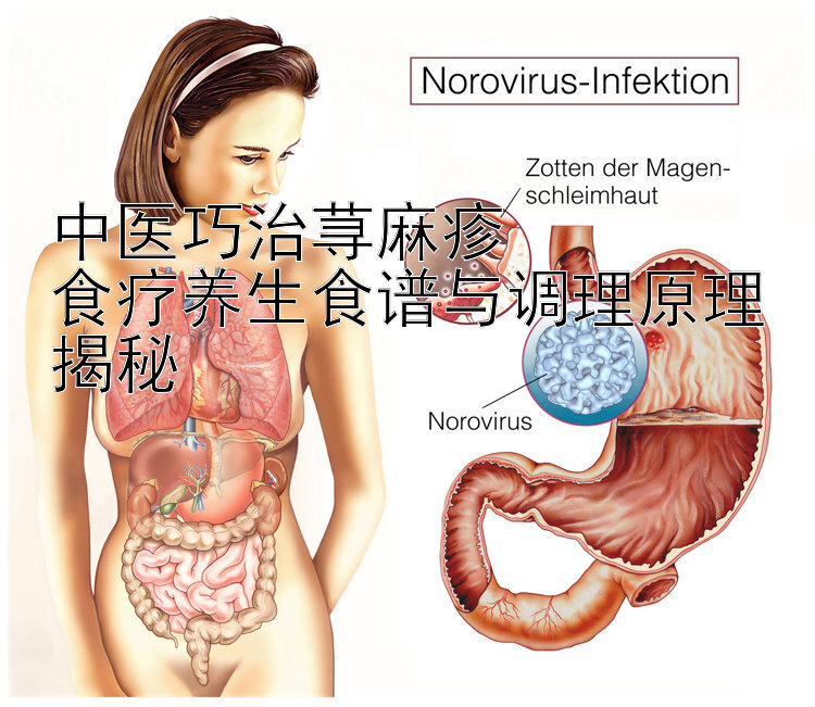 中医巧治荨麻疹  
食疗养生食谱与调理原理揭秘