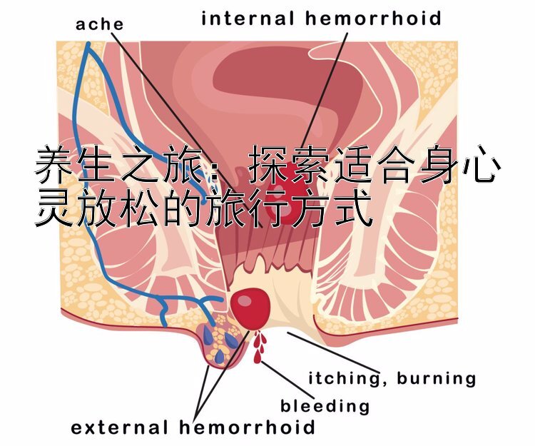 养生之旅：探索适合身心灵放松的旅行方式